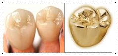 Our Dental Services7 phuket-dentist-serviceimg7
