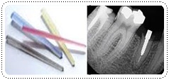 Our Dental Services8 phuket-dentist-serviceimg8